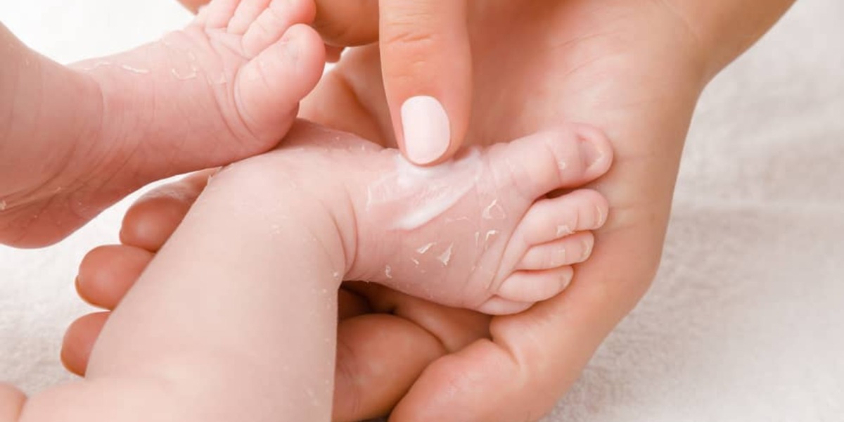Informeer Goed opgeleid gek Wat moet je doen als je baby een droge huid heeft? - Pazzox